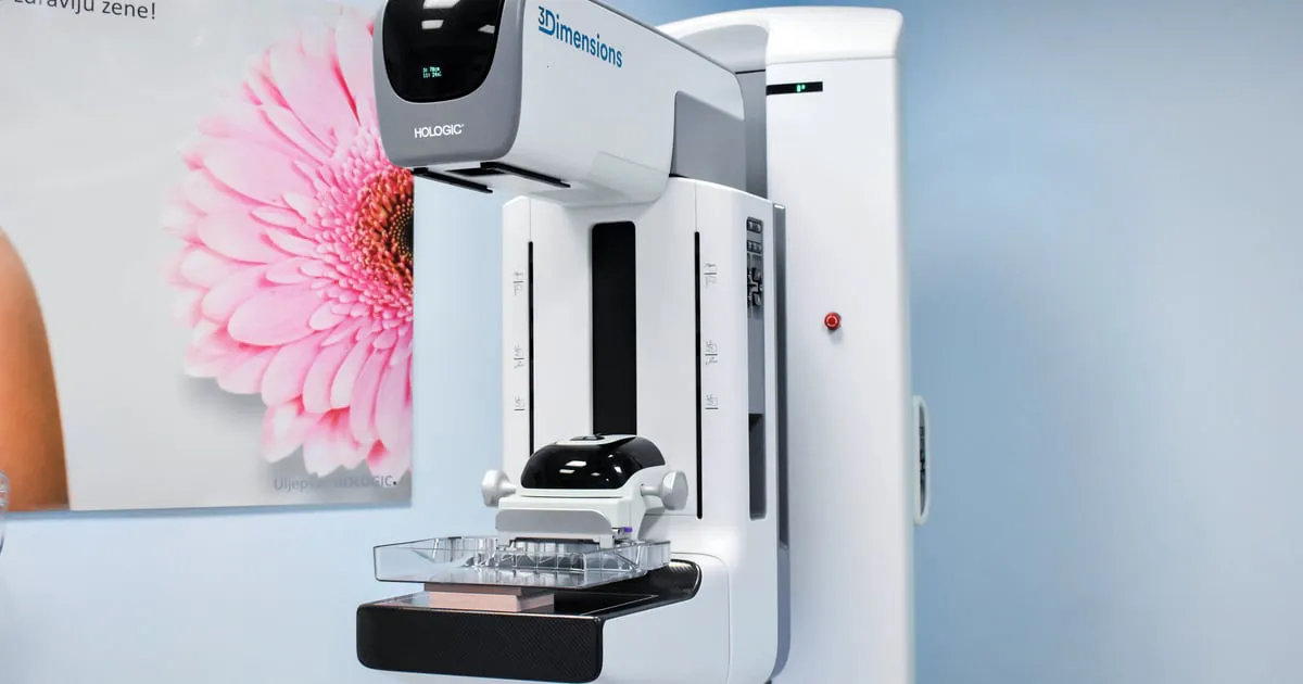 KCCG uveo kontrastnu mamografiju u rutinski rad