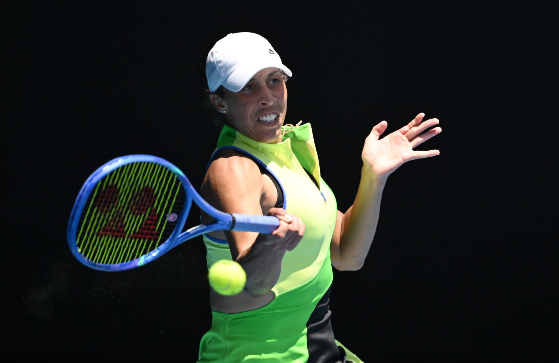 Medison Kiz preokretom do drugog kola Australijan Opena