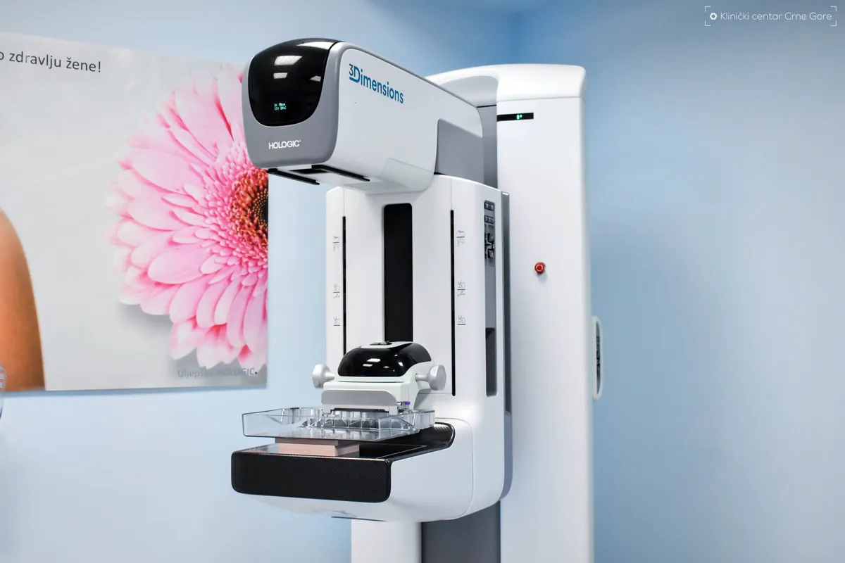 U Crnoj Gori uvedena kontrastna mamografija u klinički rad