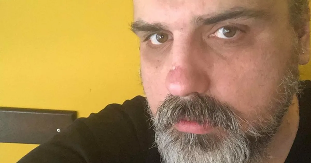 MSS upozorava na pritisak na novinare nakon pozivanja Kovačevića