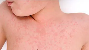 Udruženje 'Roditelji' pokrenulo inicijativu Ustavnom sudu zbog prava djece